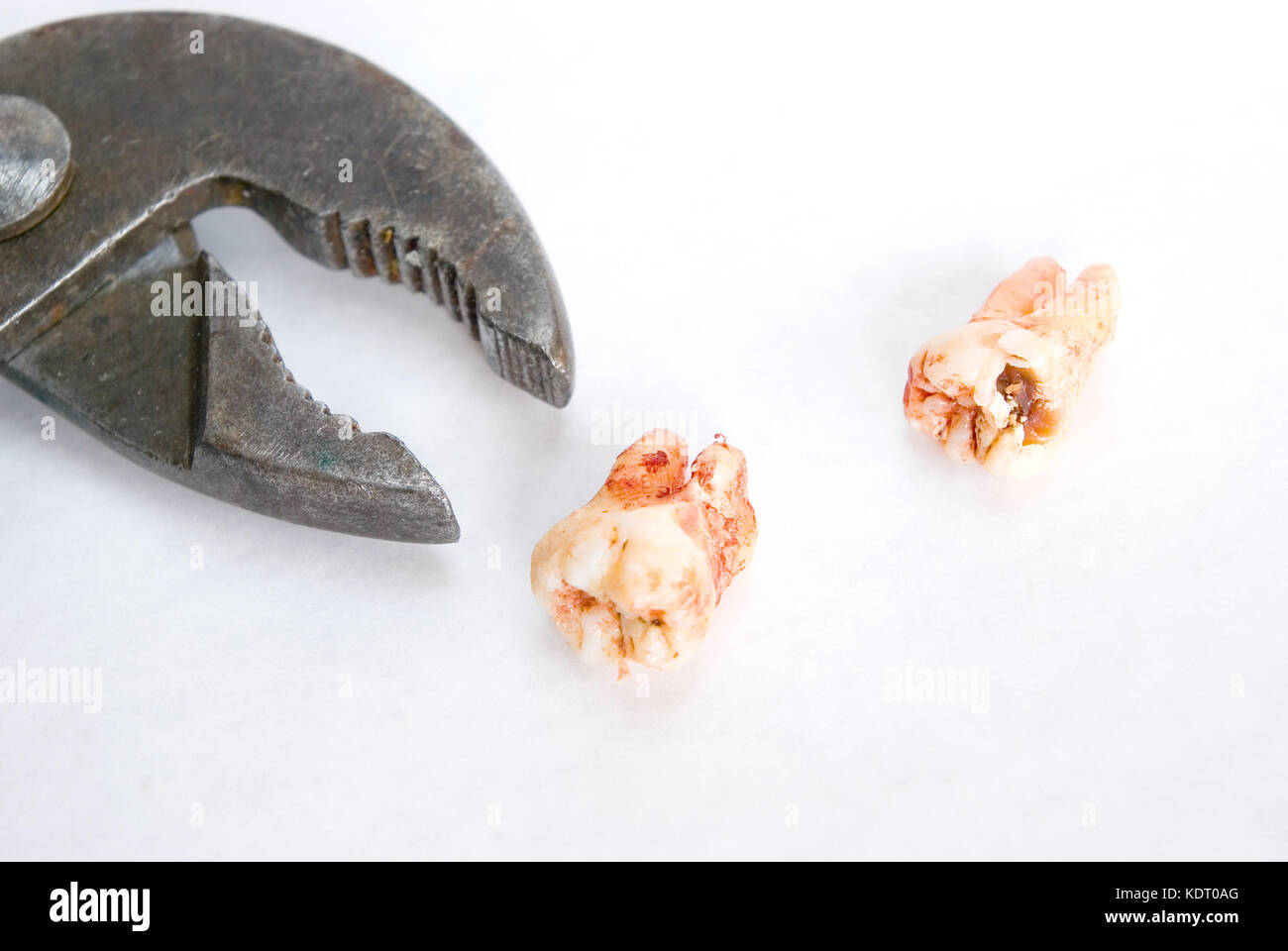 A soli denti estratti accanto a pinzette in una metafora di un macellaio-come dentista. Foto Stock