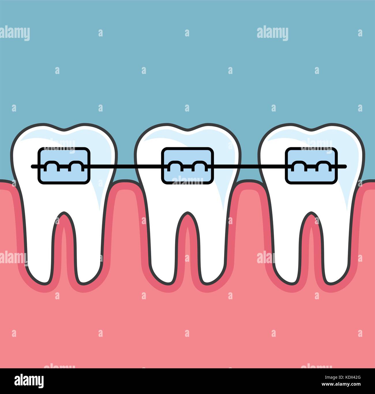 Denti con bretelle dentali - dental organizzare Illustrazione Vettoriale