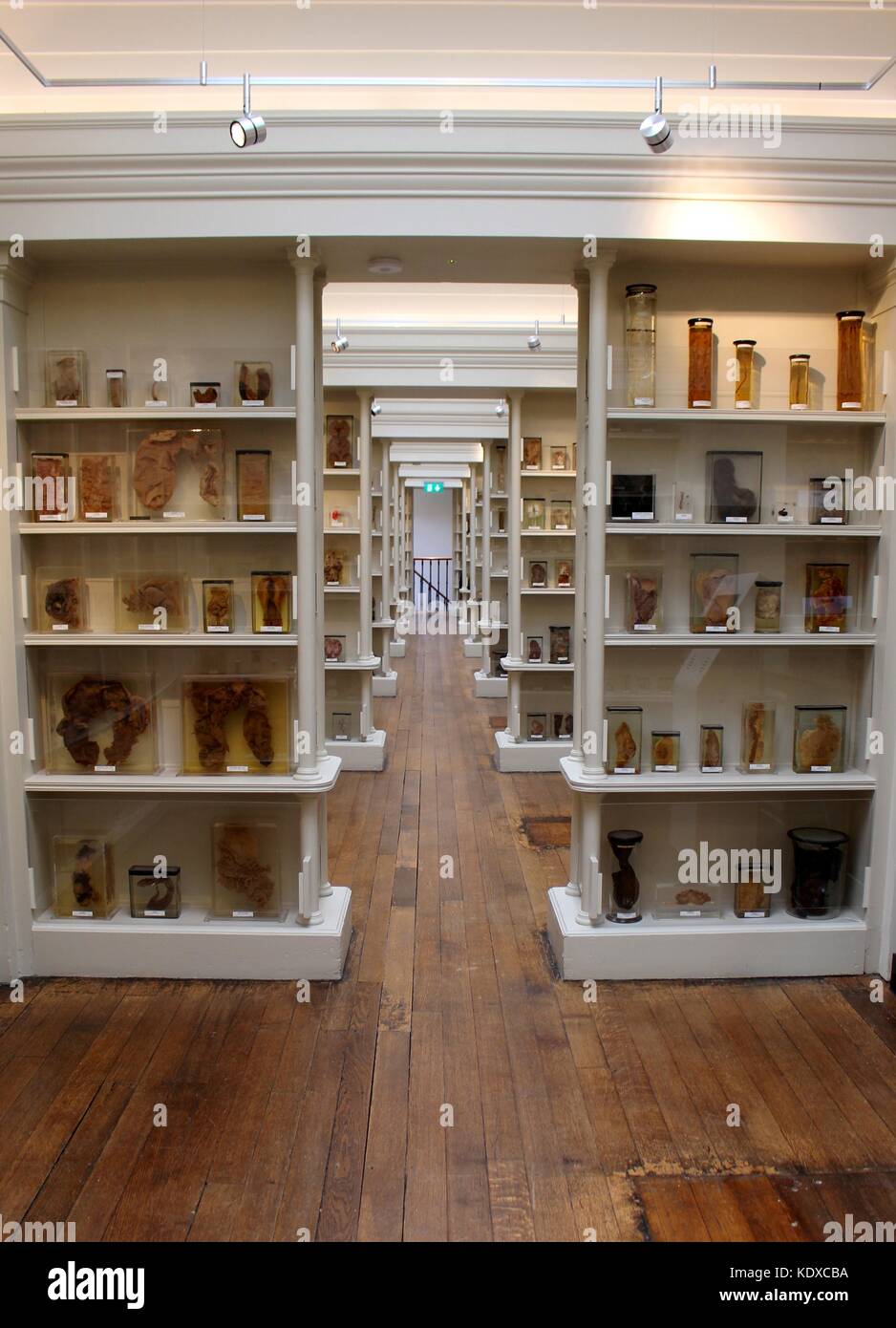 La patologia Wohl museo è sede di una delle più grandi collezioni di anatomia patologica nel mondo. Foto Stock