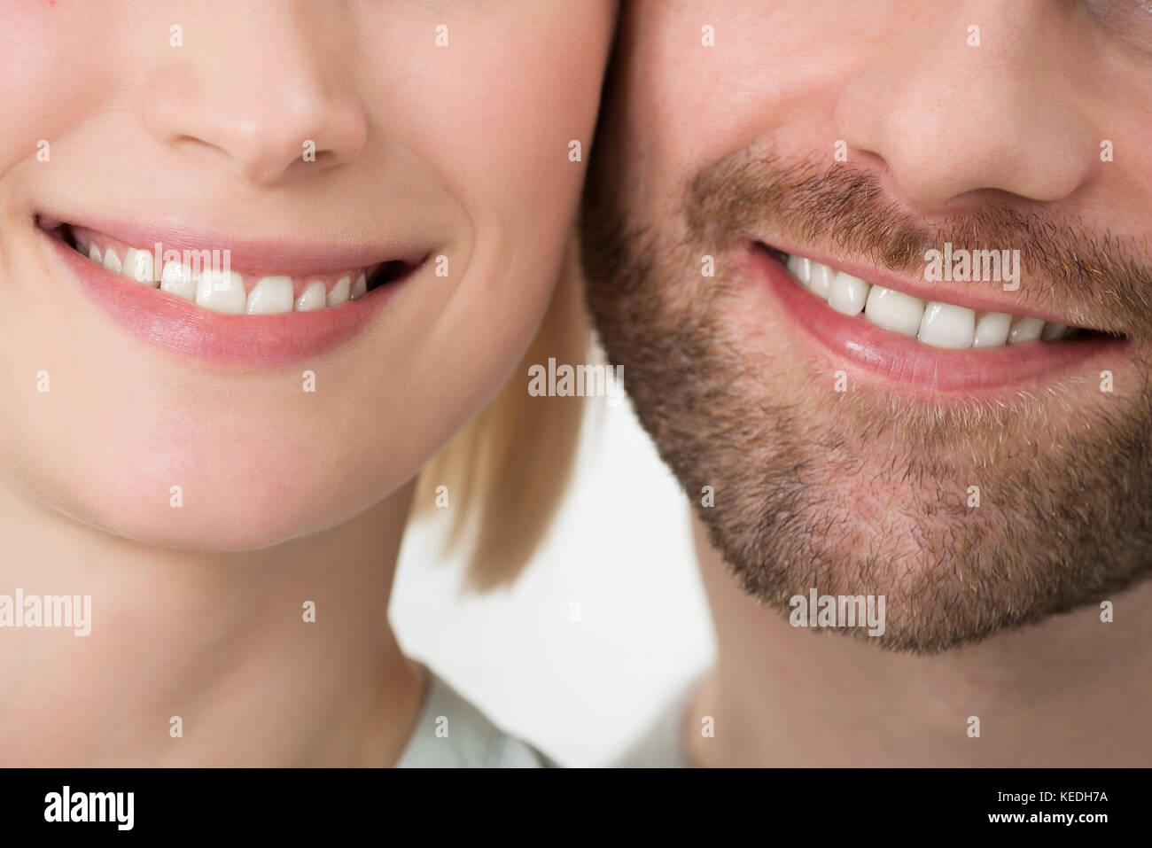 Close-up di coppia giovane con sorriso toothy Foto Stock