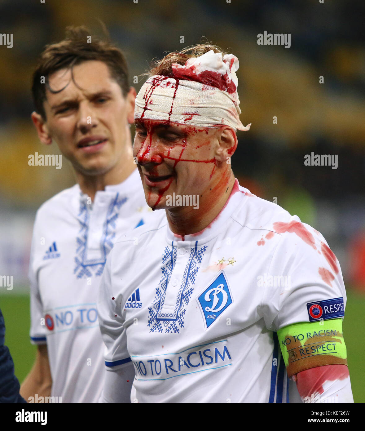 Kiev, Ucraina. 19th ottobre 2017. Domagoj Vida del FC Dynamo Kyiv coperto di sangue dopo lesioni alla testa durante la partita della UEFA Europa League contro i giovani ragazzi allo stadio NSC Olimpiyskyi a Kyiv, Ucraina. Credit: Oleksandr Prykhodko/Alamy Live News Foto Stock