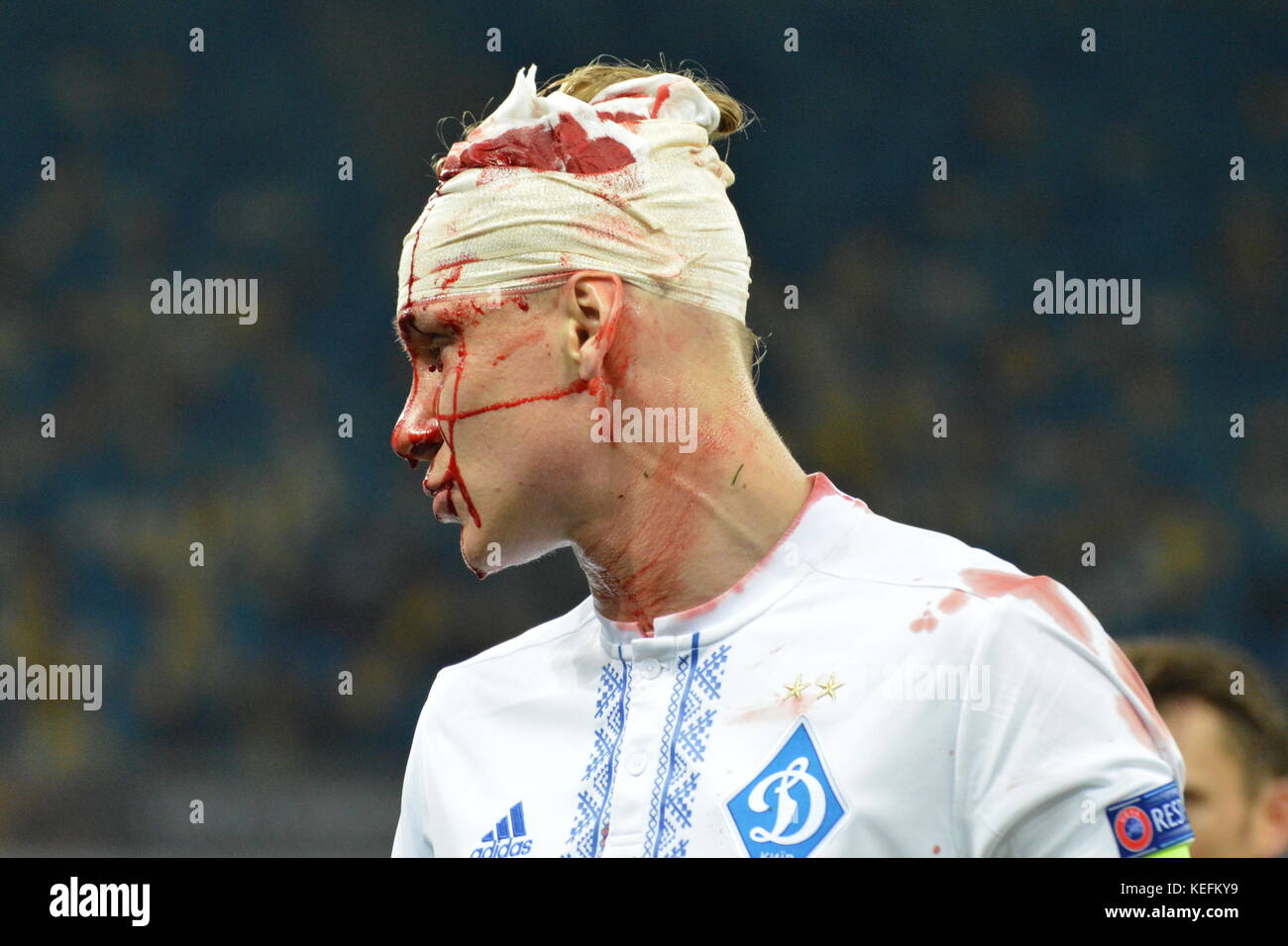 Kiev, Ucraina. Xix oct, 2017. lettore Dinamo Kiev domagoj vida dopo sostenere un pregiudizio alla sua testa durante UEFA Europa League vs fc dynamo credito: alexandr gusew/Pacific press/alamy live news Foto Stock