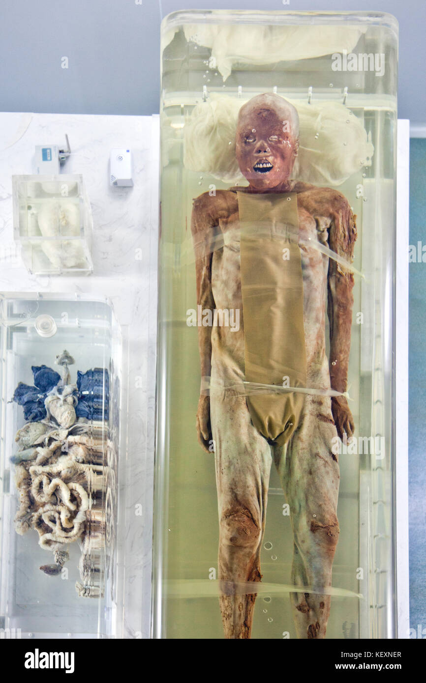 La mummia di 2000 anni MR. Sui, è la mostra più popolare al Museo di Jingzhou, Jingzhou, Cina. Le guide turistiche tendono a riferirsi a questa mummia come un corpo succoso. La mummia è conservata in una scatola ermeticamente sigillata, e i visitatori hanno una vista dall'alto. Si noti che i suoi intestini sono in vista nel contenitore a sinistra. Jingzhou è una città a livello prefettura nel sud di Hubei, in Cina, situata sulle rive del fiume Yangtze. Foto Stock