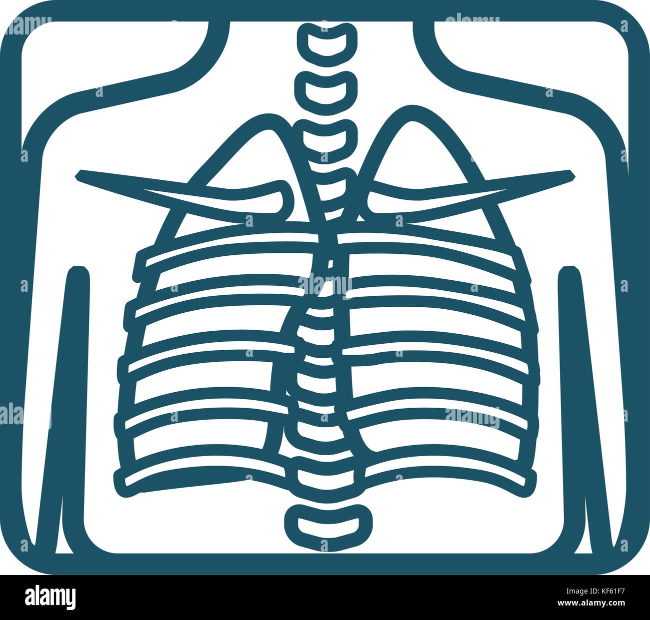 Polmoni umani xray Illustrazione Vettoriale