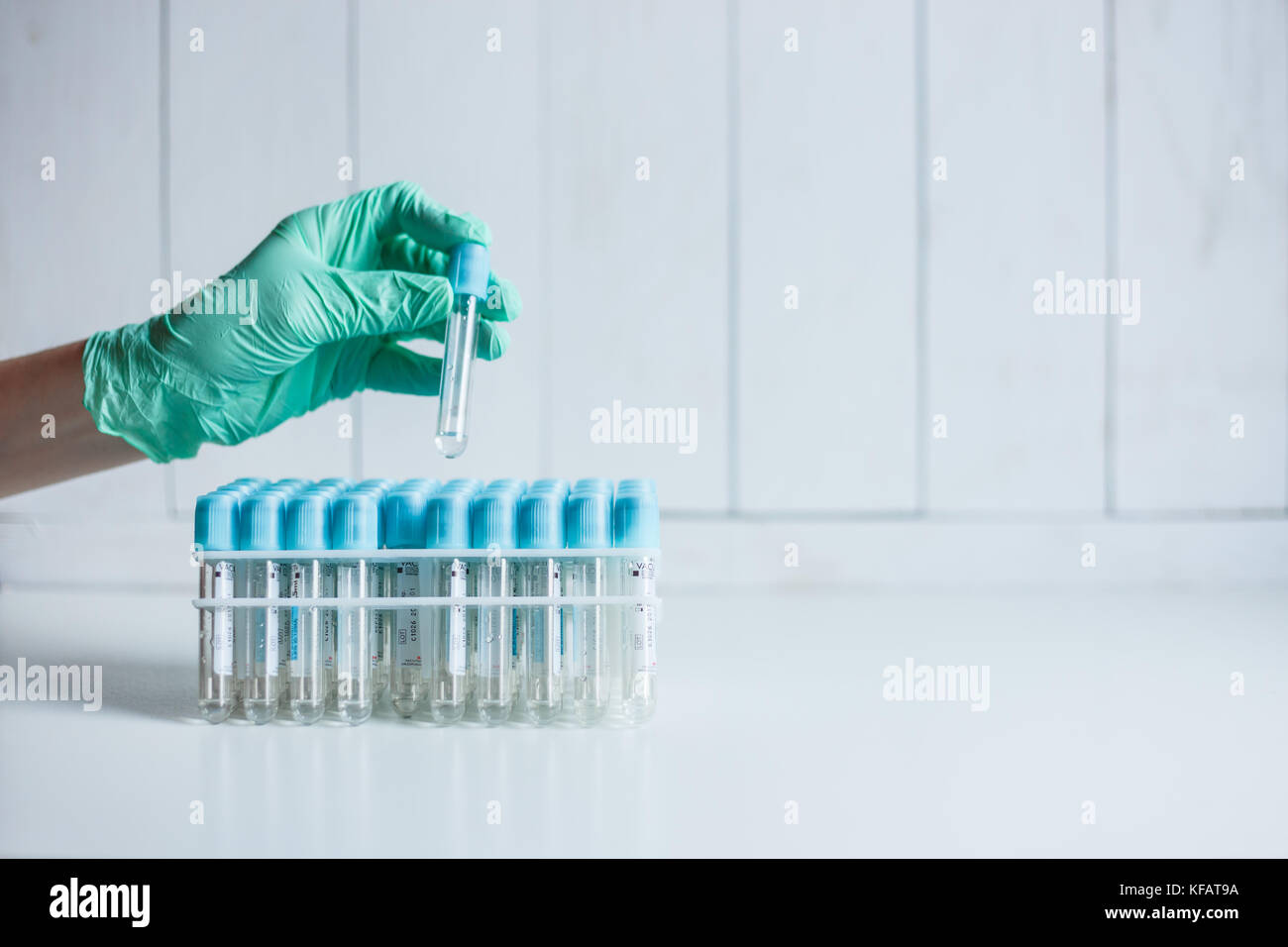 Mano del medico infermiere al laboratorio prende un tubo vuoto dal cassetto per il prelievo di sangue per analisi Foto Stock