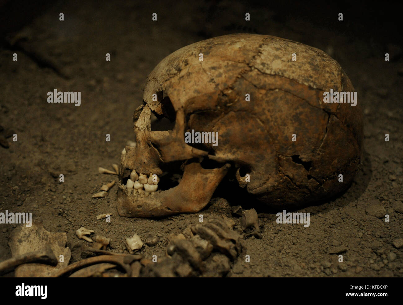 Età dei vichinghi Birka. ragazza. Morì all età di 6 anni. Decimo secolo. scheletro. cranio. Il museo storico. Stoccolma Svezia. Foto Stock