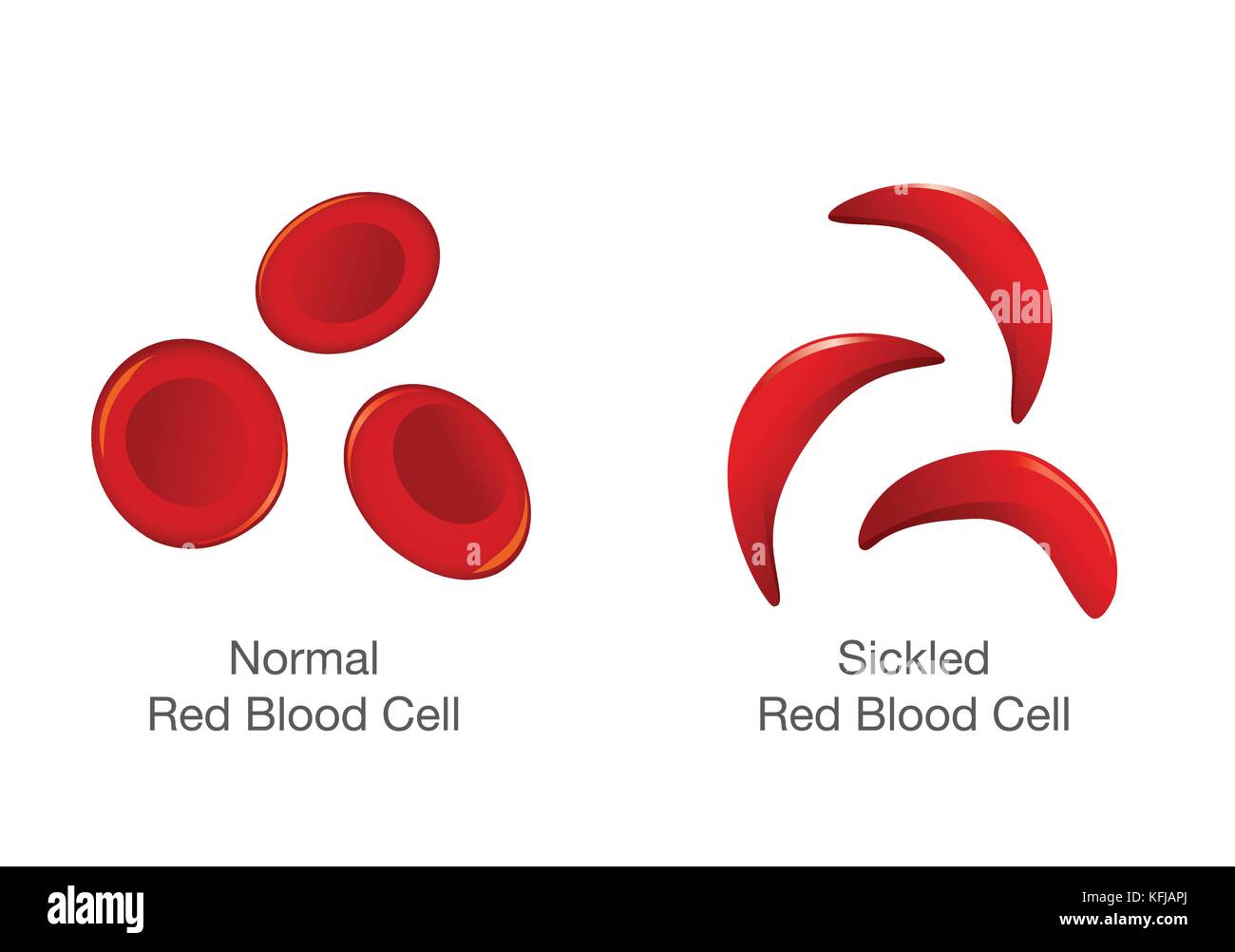 La differenza di normale delle cellule rosse del sangue e di cellule a falce. Illustrazione Vettoriale
