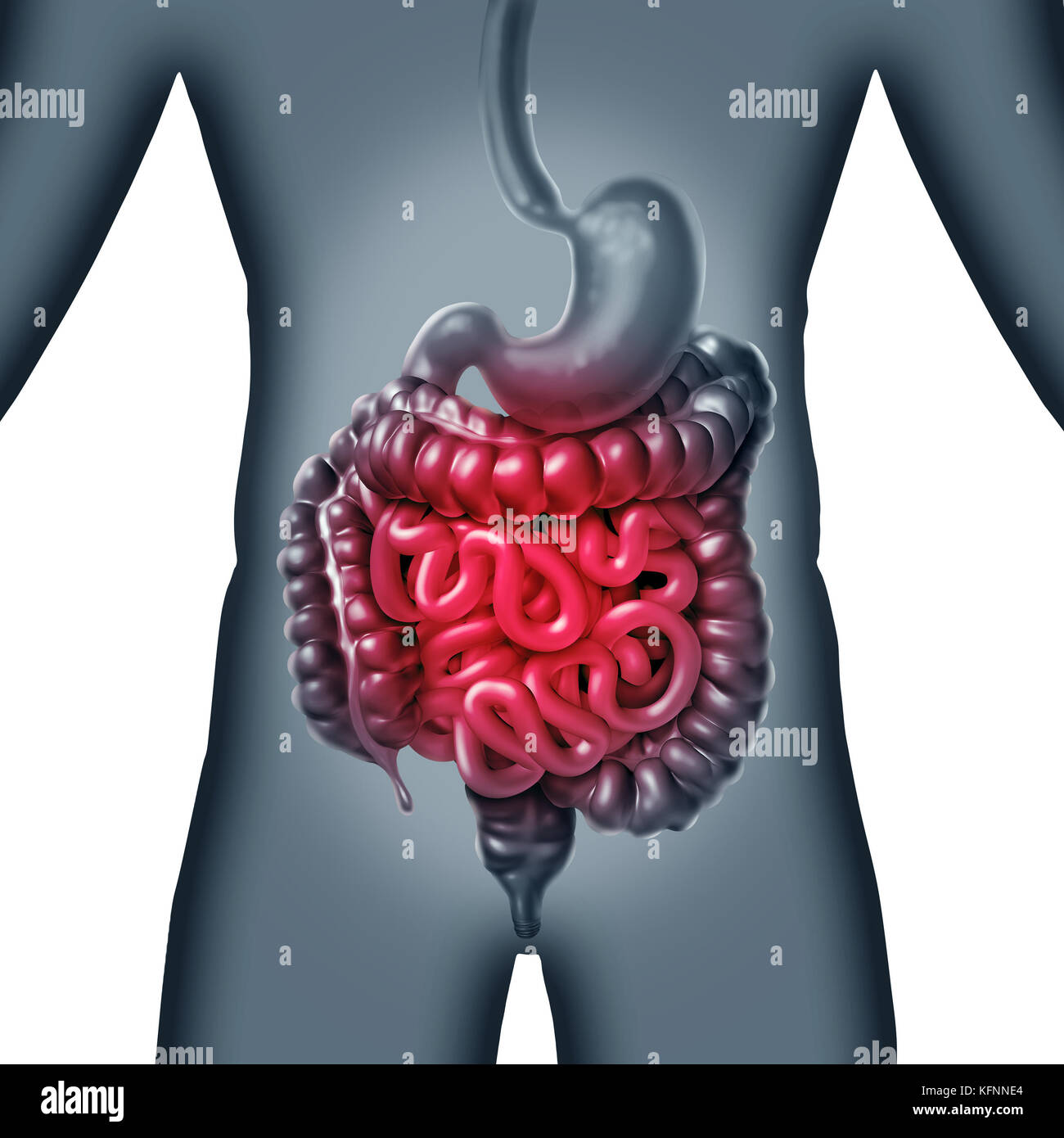 Intestinale e intestino il dolore e la digestione gastrointestnal infiammazione problema come la digestione Malessere o stitichezza e infezione. Foto Stock