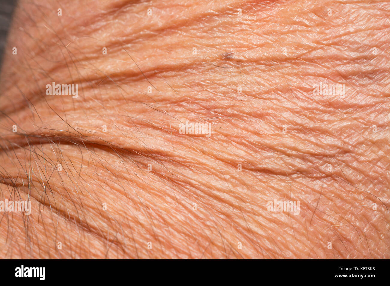 Texture della pelle con rughe sul corpo del maschio maturo Foto Stock
