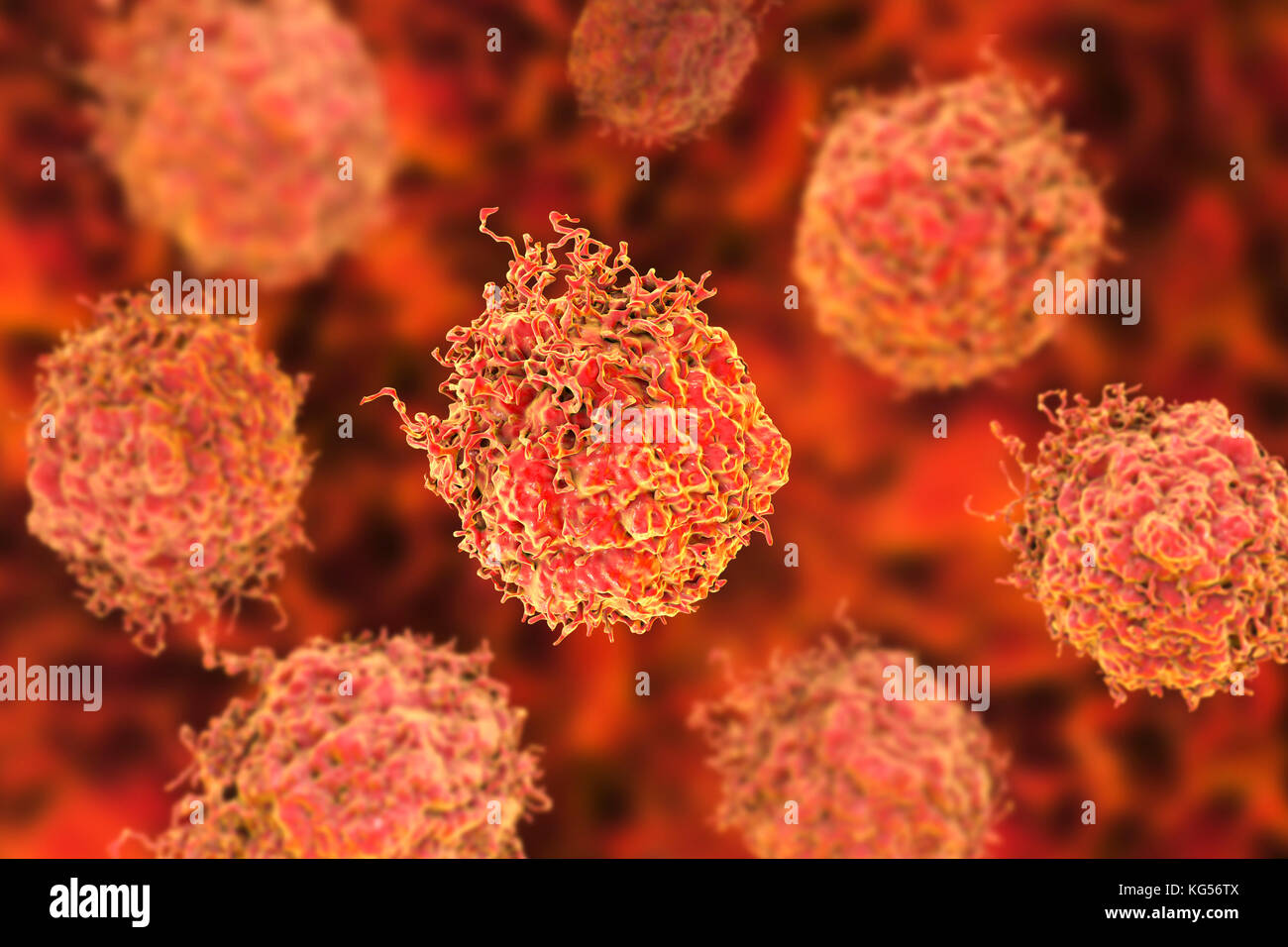 Cellule di cancro della prostata, illustrazione del computer. Foto Stock