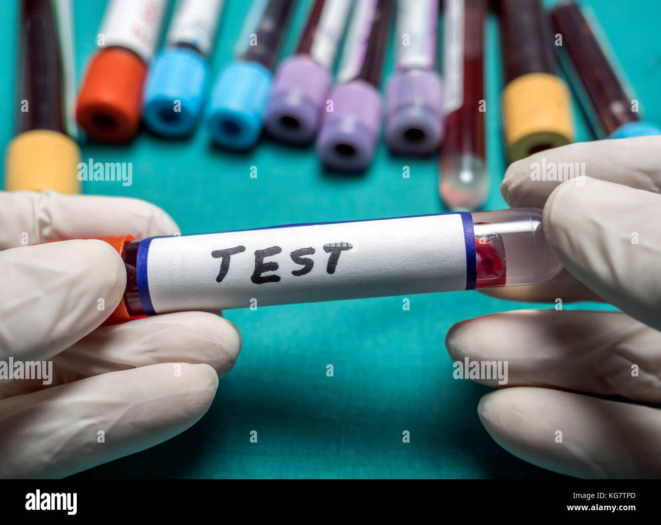 Fiala per il prelievo di campioni di sangue, farmaco laboratorio di controllo, immagine concettuale Foto Stock