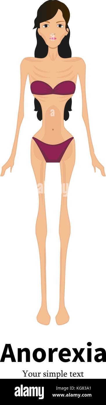 Vector cartoon ragazza con anoressia nervosa Illustrazione Vettoriale