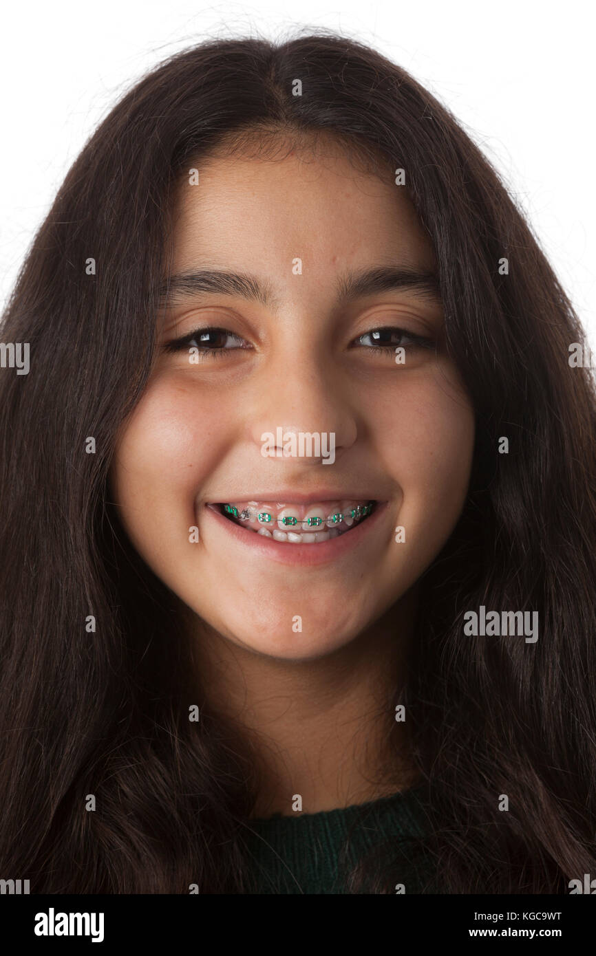 Ritratto di un sorridente ragazza adolescente con bretelle dentali Foto Stock