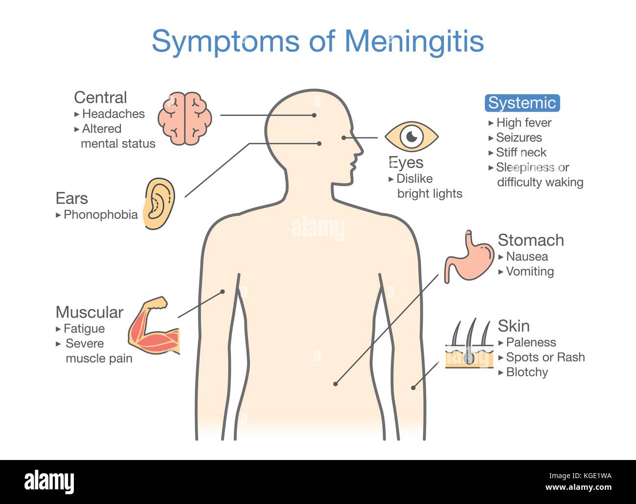Diagramma per mostrare i sintomi del paziente con malattia di meningite. Illustrazione Vettoriale