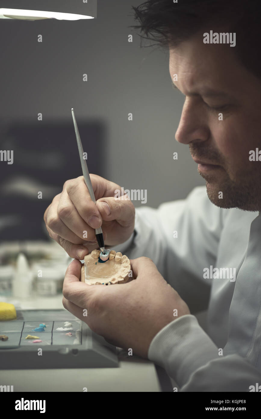 Protesi dentale, dente artificiale di protesi, mani lavorando sulla dentiera, denti finti. Foto Stock