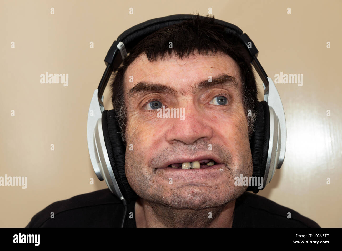 Uomo con difficoltà di apprendimento ascolto di musica Foto Stock