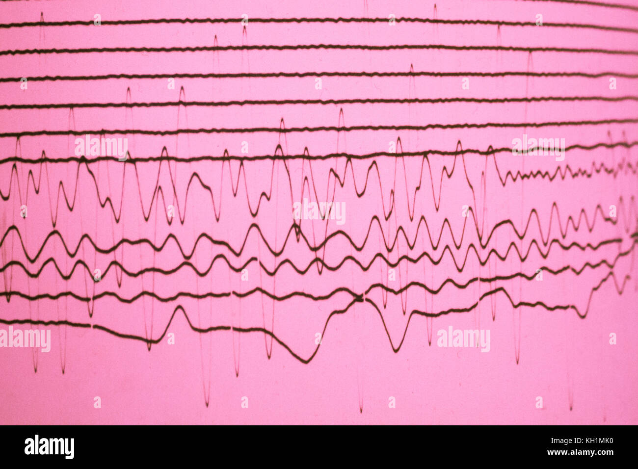 Le linee che caratterizzano la Scala del pericolo di un terremoto su sfondo rosa. Foto Stock