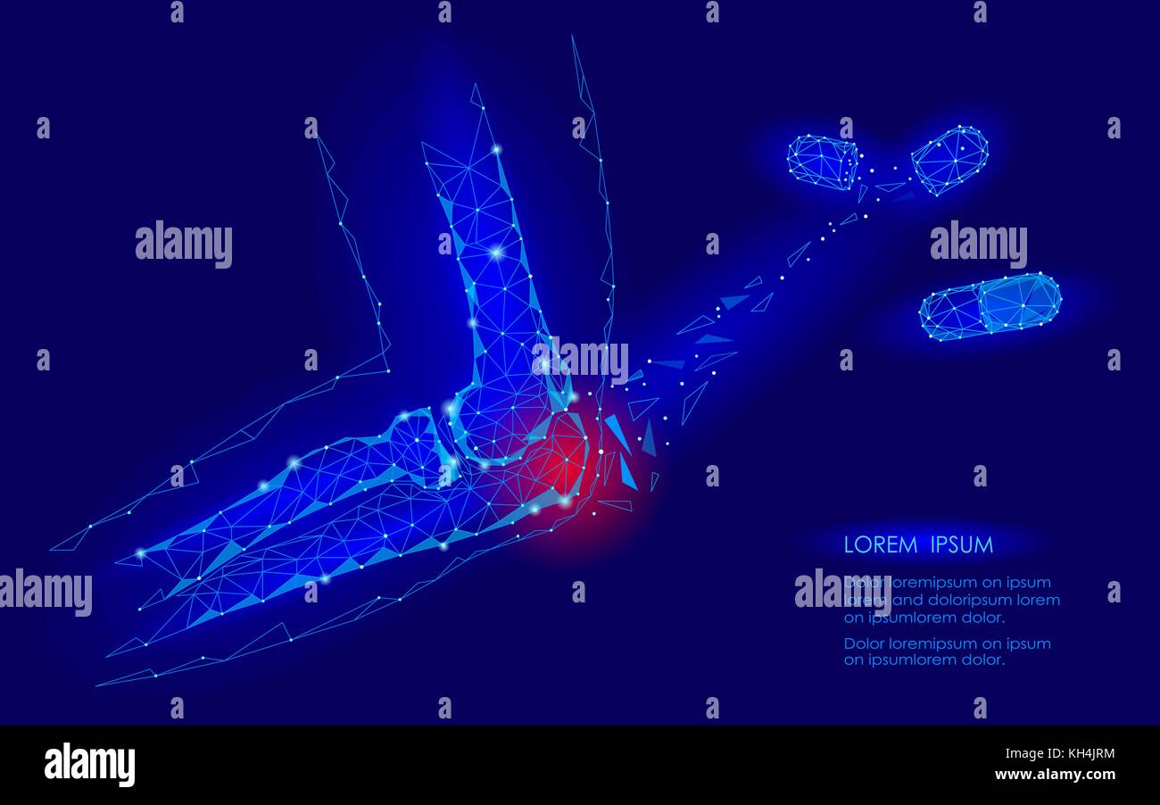 Capsula di farmaco cura il giunto a gomito malattia. rosso area dolore bassa poli geomentic medicina del futuro concetto di tecnologia. innovazione scienza della medicina. braccio lesioni ulna connessione poligonale illustrazione vettoriale Illustrazione Vettoriale