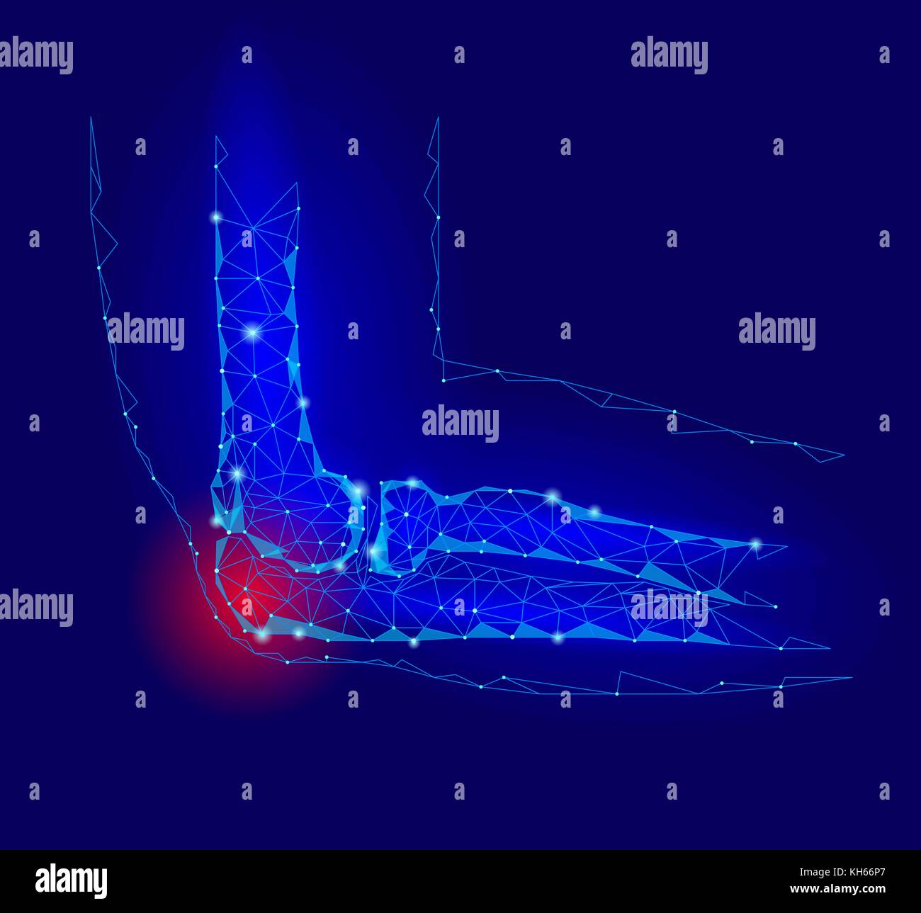 Gomito dolorosa malattia comune. rosso area dolore bassa poli geomentic medicina del futuro concetto di tecnologia. innovazione scienza della medicina. braccio lesioni ulna connessione poligonale illustrazione vettoriale Illustrazione Vettoriale