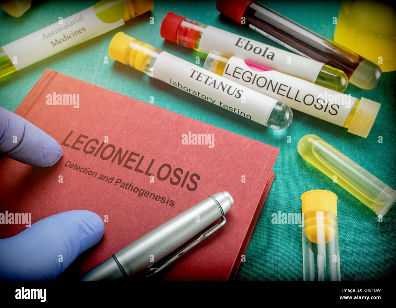 Medico detiene il libro sulla legionellosi in un ospedale Foto Stock