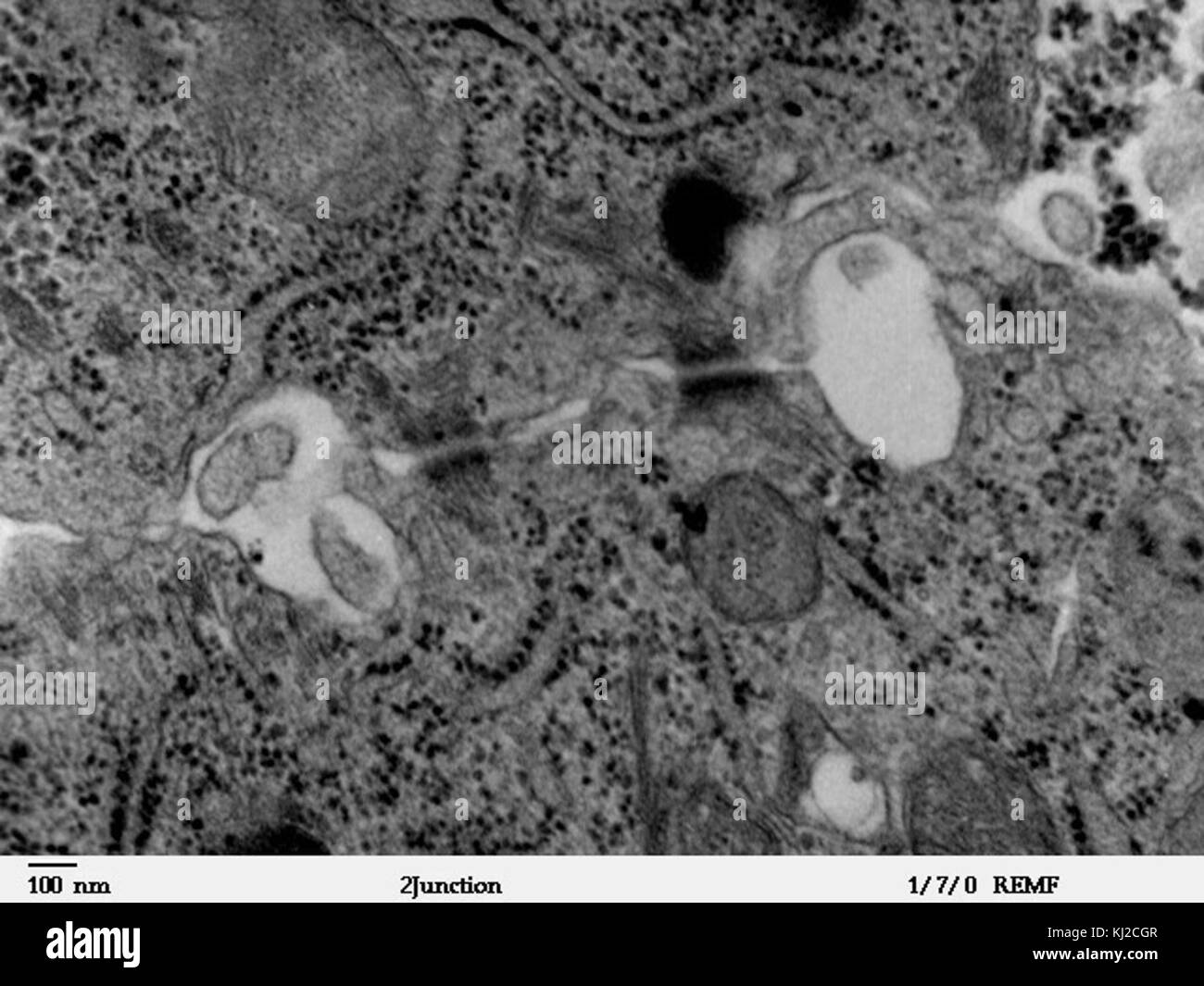 Due desmosomi - TEM Foto Stock