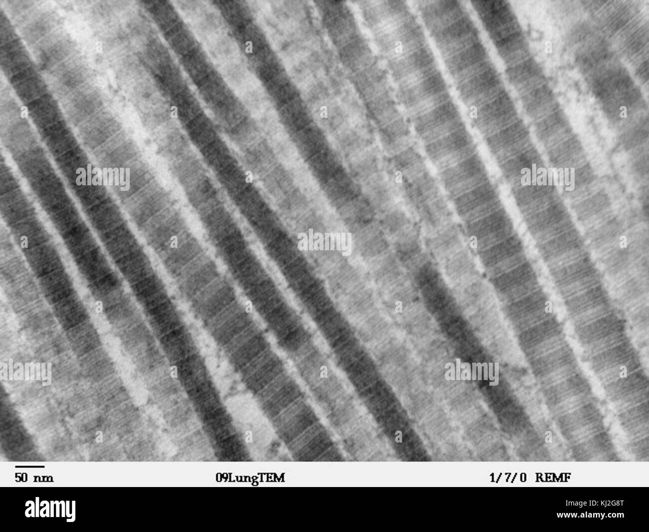 Fibre di collagene di tipo I - TEM Foto Stock