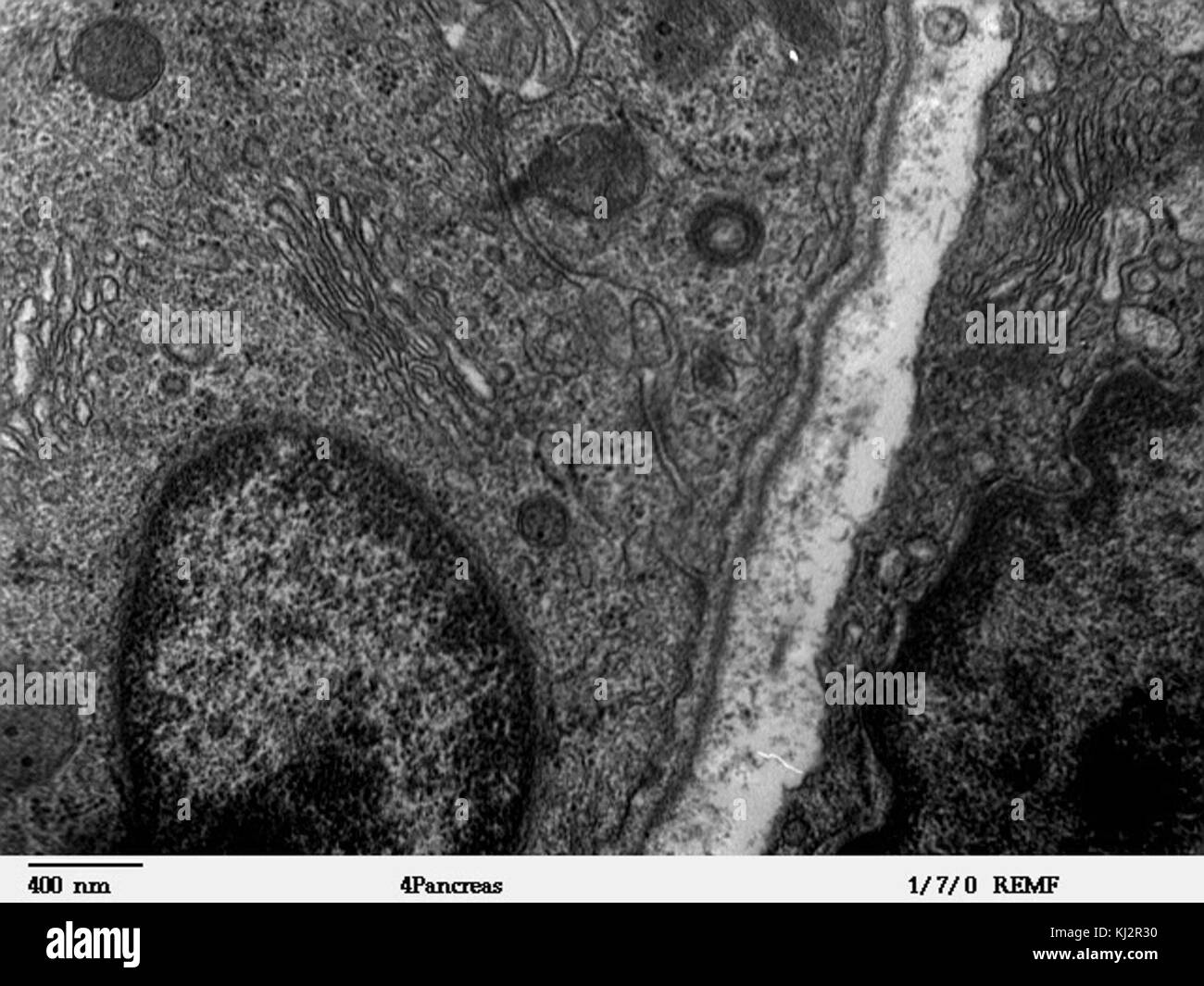 Cellule pancreatiche - TEM Foto Stock