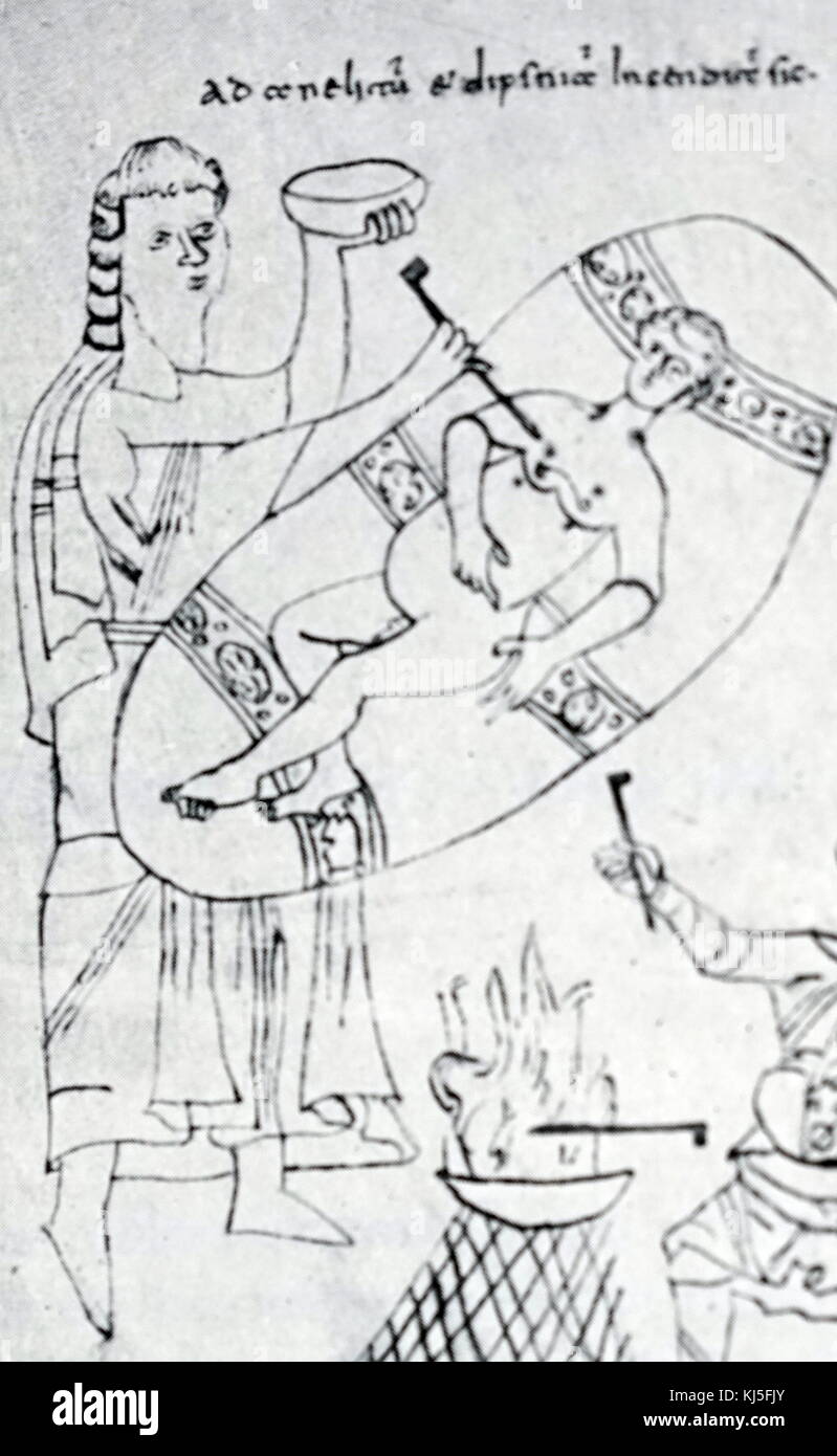 Illustrazione medievale raffigurante un intervento chirurgico. Datata IX secolo Foto Stock