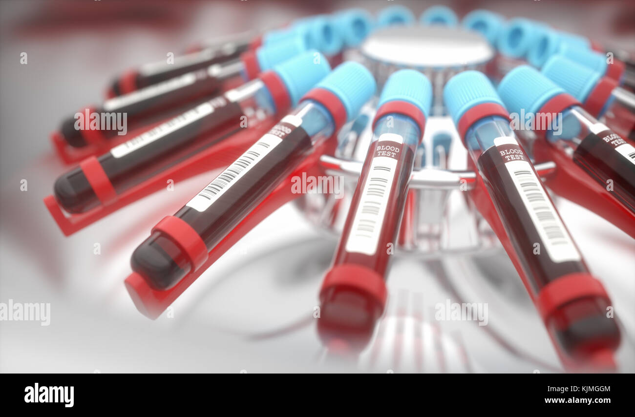 Attrezzature da laboratorio per la centrifugazione del sangue. Concetto di immagine di un esame del sangue. Foto Stock