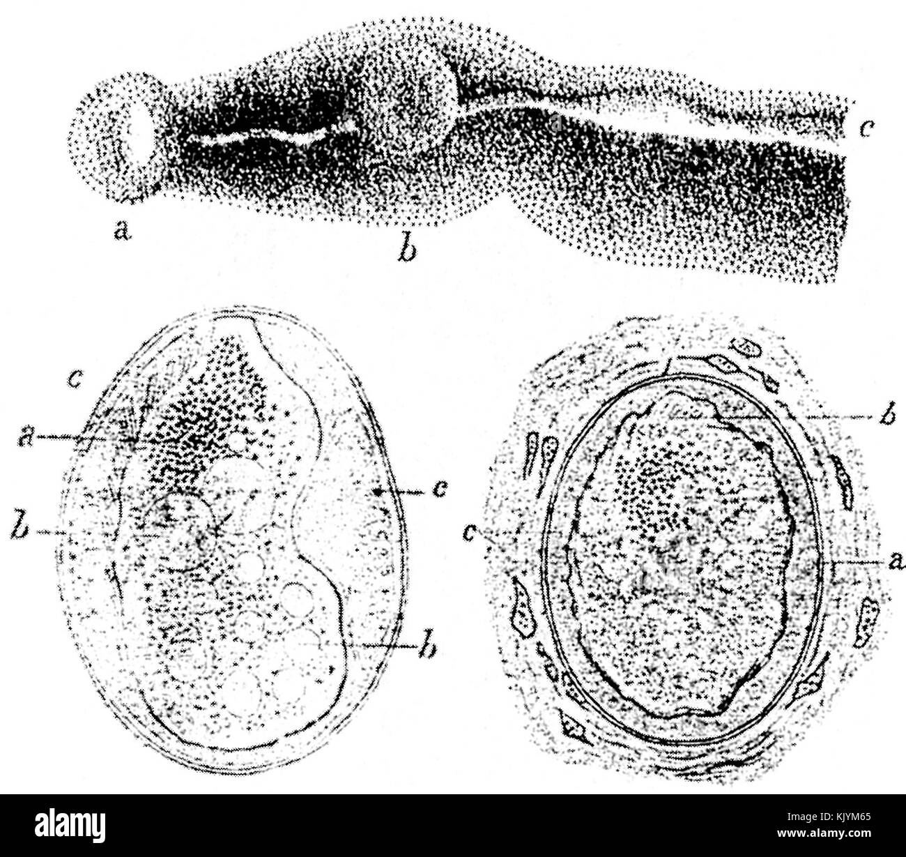 Schistosoma japonicum parassiti e uova schizzi da Katsurada Dr. 1904 Foto Stock