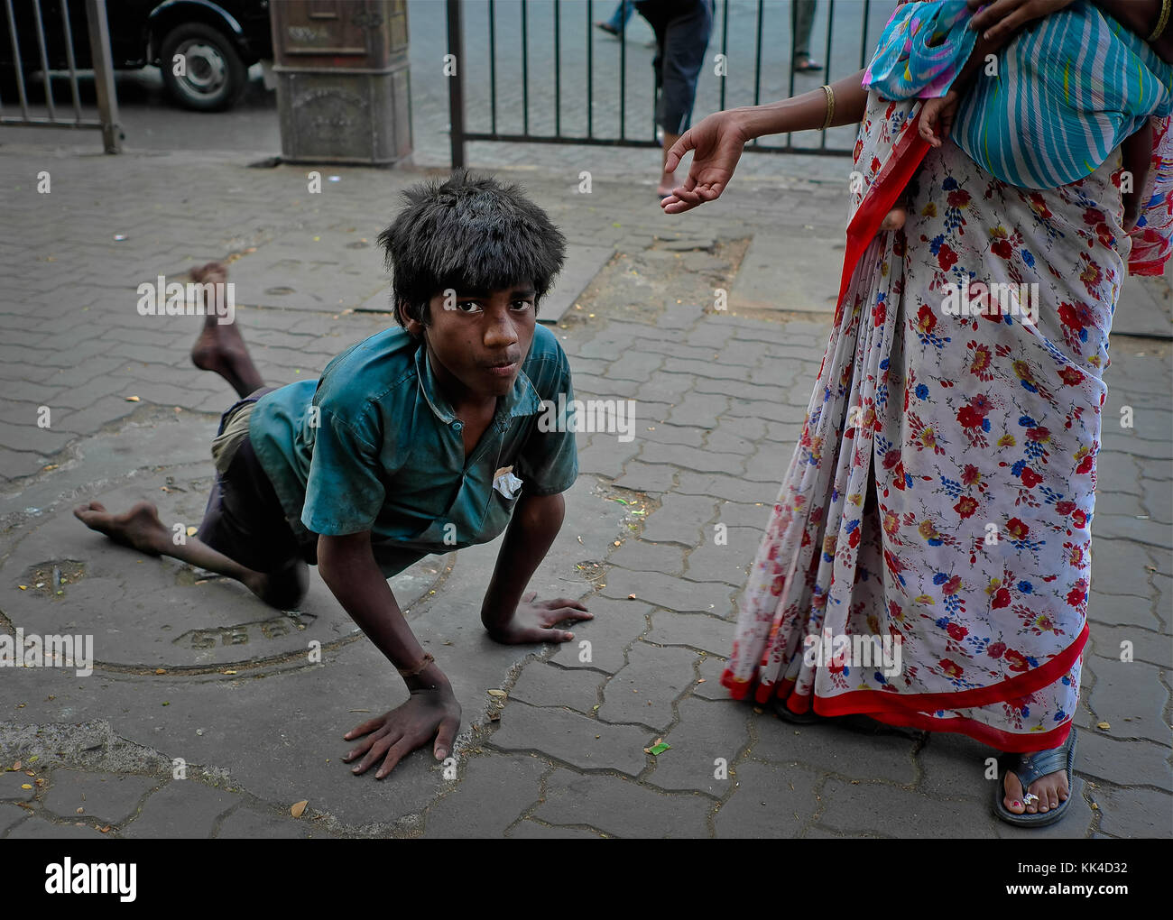 Indian Glance - 23/05/2010 - - il bambino disabili - Sylvain Leser / le Pictorium Foto Stock