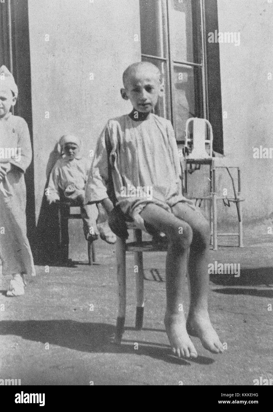 Questo riferimento evidenzia la ricerca clinica condotta durante la carestia nel ghetto di Varsavia nel 1942. La ricerca mirava a documentare gli effetti della grave scarsità alimentare sulla salute, contribuendo alla più ampia comprensione delle malattie legate alla fame durante la guerra. Foto Stock