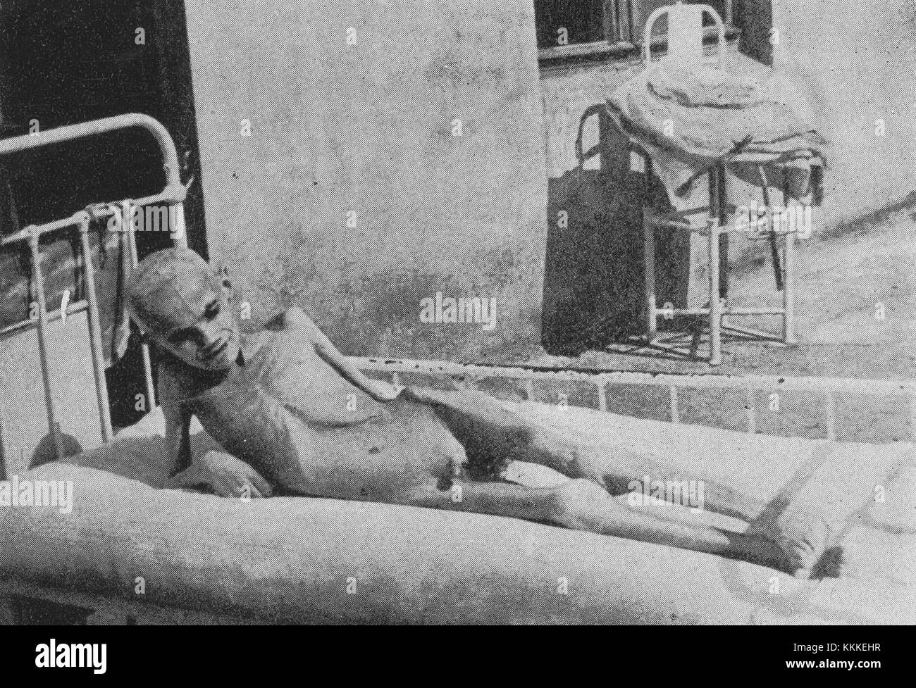 Una descrizione della ricerca clinica sulle malattie della fame condotta nel ghetto di Varsavia nel 1942, concentrandosi sugli effetti della carestia e sul costo umano dell'Olocausto. Foto Stock