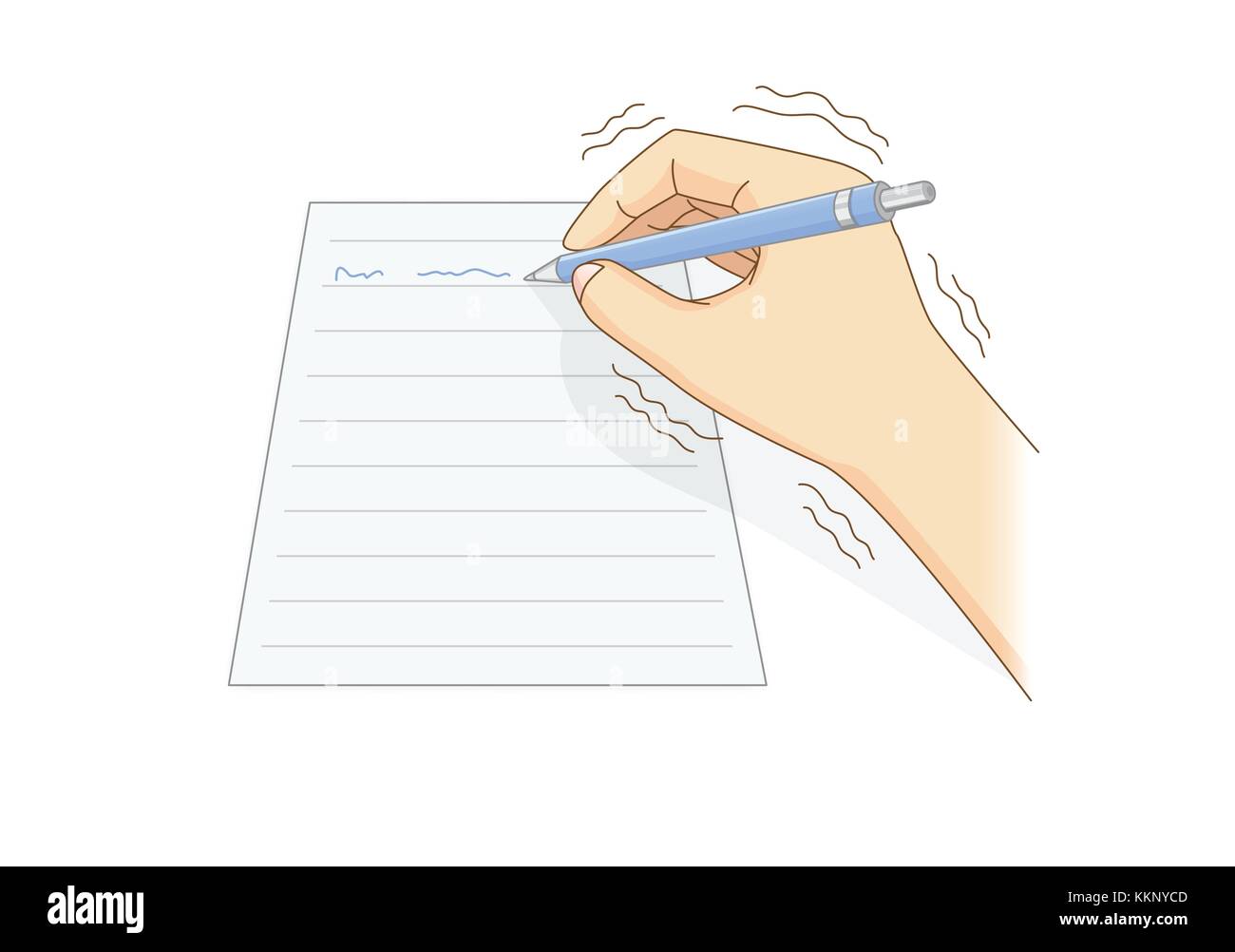 Mano umana sono sintomo del tremore mentre la scrittura con una penna. Illustrazione Vettoriale