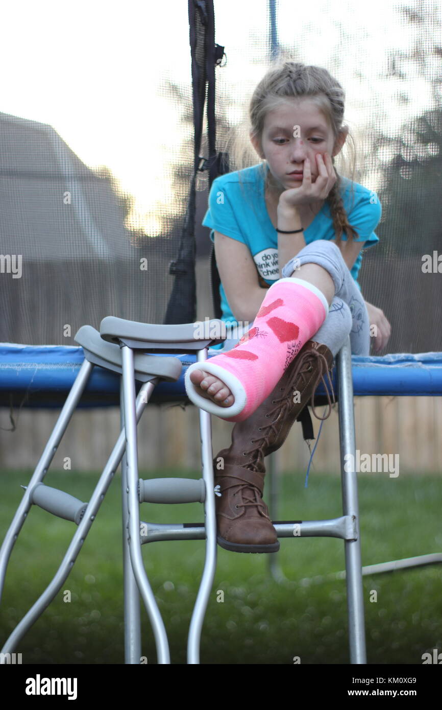 Triste ragazza seduta sul trampolino con colori rosa e blu cast sulla gamba o piede Foto Stock