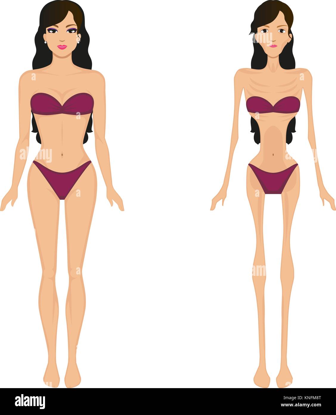 Illustrazione Vettoriale femmina di anoressia. Le donne la bulimia Illustrazione Vettoriale