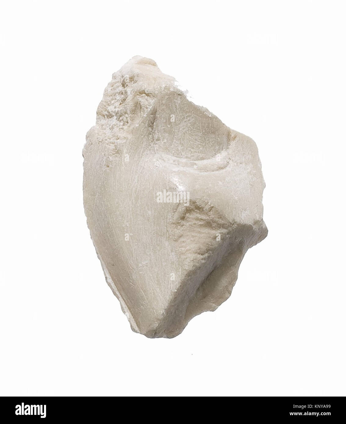 Illustrazione anatomica storica di un frammento di dito che mostra la struttura ossea e le articolazioni. Foto Stock