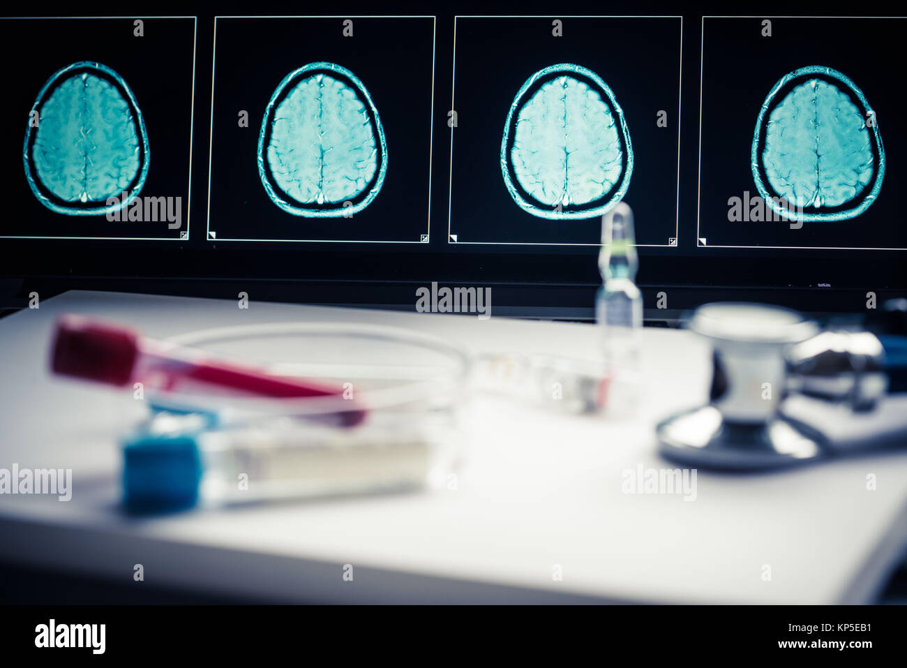 Computer che mostra una risonanza magnetica (RM) scansione di una testa umana contenenti un cervello integro. Foto Stock