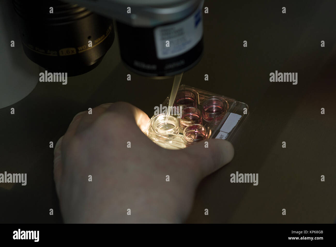 Assistito tecnologia riproduttiva Foto Stock