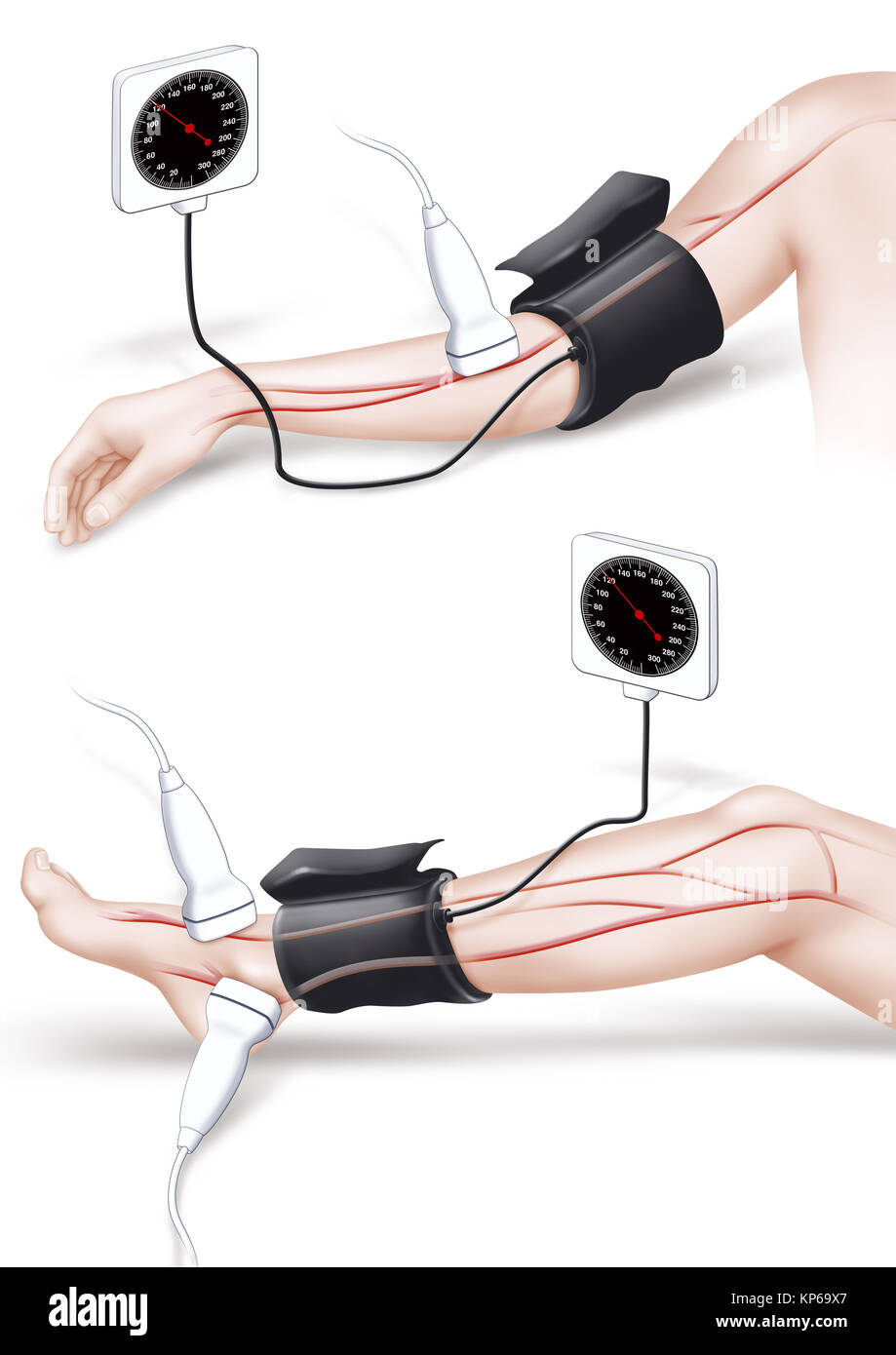 Pressione arteriosa, illustrazione Foto Stock