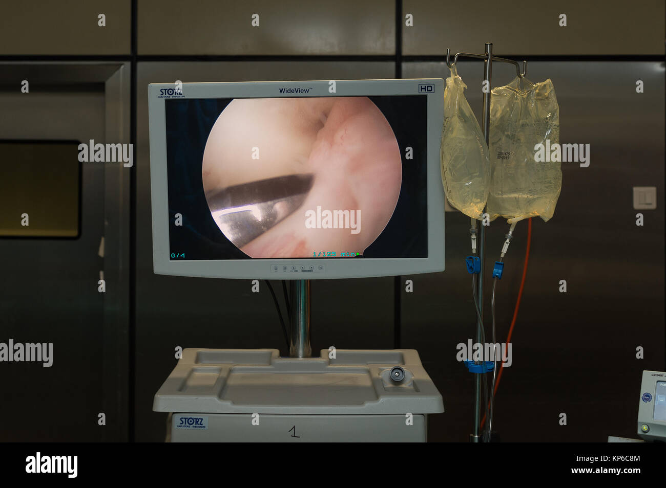 La chirurgia del legamento Foto Stock