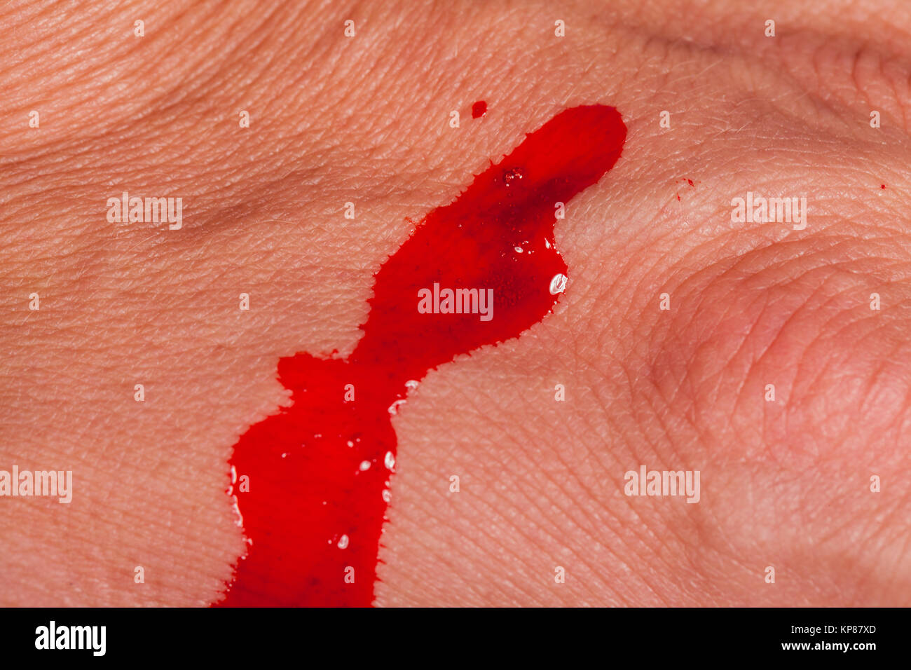 Kleine Spritze mit Nadel in der Haut Ader Vene Blut Drogen Medizin als Nahaufnahme Macro Foto Stock