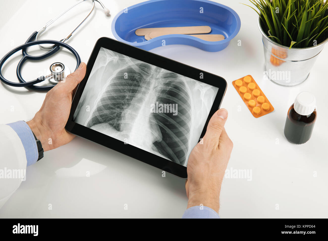 Medico analisi polmonare del paziente x-ray risultati sulla tavoletta digitale Foto Stock