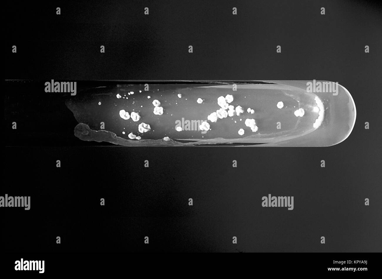 Nella foto è un agar Sabouraud destrosio coltura slant del fungo Paracoccidioides brasiliensis cresciuti a 37 C. Questo è il solo agente eziologico per la malattia Paracoccidioidomycosis, 1969. Paracoccidioides brasiliensis è geograficamente limitata alle zone del Sud e America centrale. Immagine cortesia CDC/Dott. William Kaplan. Foto Stock