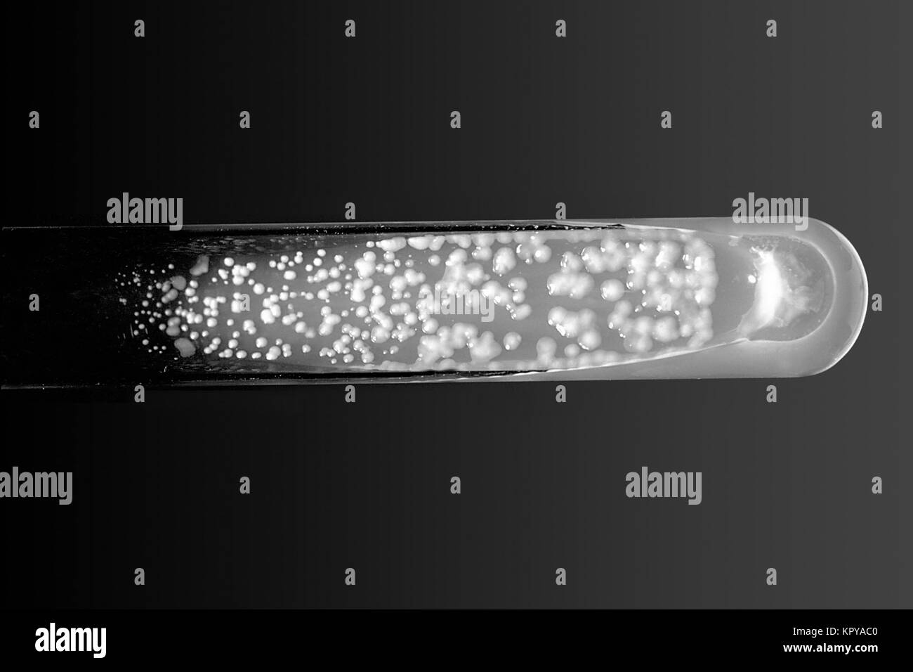 Nella foto è un agar Sabouraud destrosio coltura slant del fungo Cryptococcus neoformans cresciuti a 37 C. in pericolo di vita infezioni causate dall'incapsulato agente patogeno fungino Cryptococcus neoformans sono aumentate costantemente nel corso degli ultimi dieci anni a causa dell'insorgenza di AIDS, e l'utilizzo esteso di farmaci immunosoppressori, 1969. Immagine cortesia CDC/Dott. William Kaplan. Foto Stock