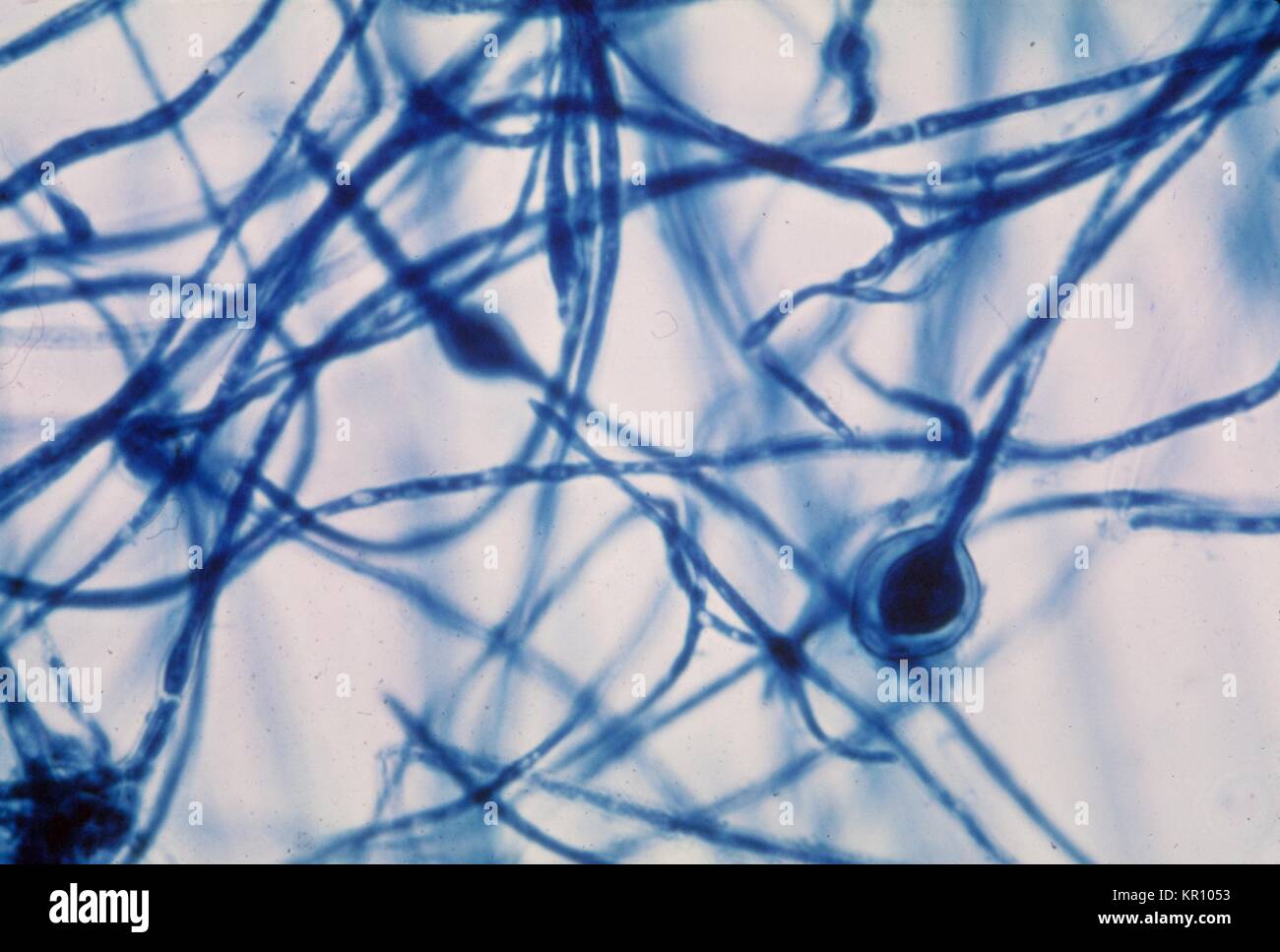 Tale micrografia rivela il terminale chlamydospores del fungo Microsporum audouinii, 1964. La presenza del terminale apiculate chlamydospores è la più caratteristica di Microsporum audouinii . I membri di questo genere sono considerati funghi filamentosi, che può essere causa di varie infezioni della pelle, dei capelli e delle unghie. Immagine cortesia CDC/Dott. Lucille K. Georg. Foto Stock