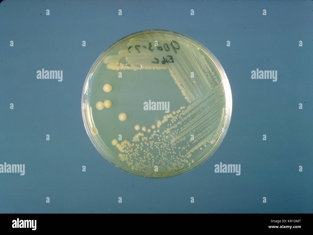 Si tratta di un tripticasi soia piastra di agar coltura di Enterobacter sakazakii dopo tre giorni di crescita a 25 <SUP>{gradi}</sup> C. Enterobacter sakazakii, gram-negativi, a forma di asta, batterio dalla famiglia enterobatteriacee, 1978. E. sakazakii è associata con una malattia rara, ma spesso fatale forma di meningite neonatale con un tasso di mortalità del 40 al 80 per cento. Immagine cortesia CDC/Dott. J. J. agricoltore. Foto Stock