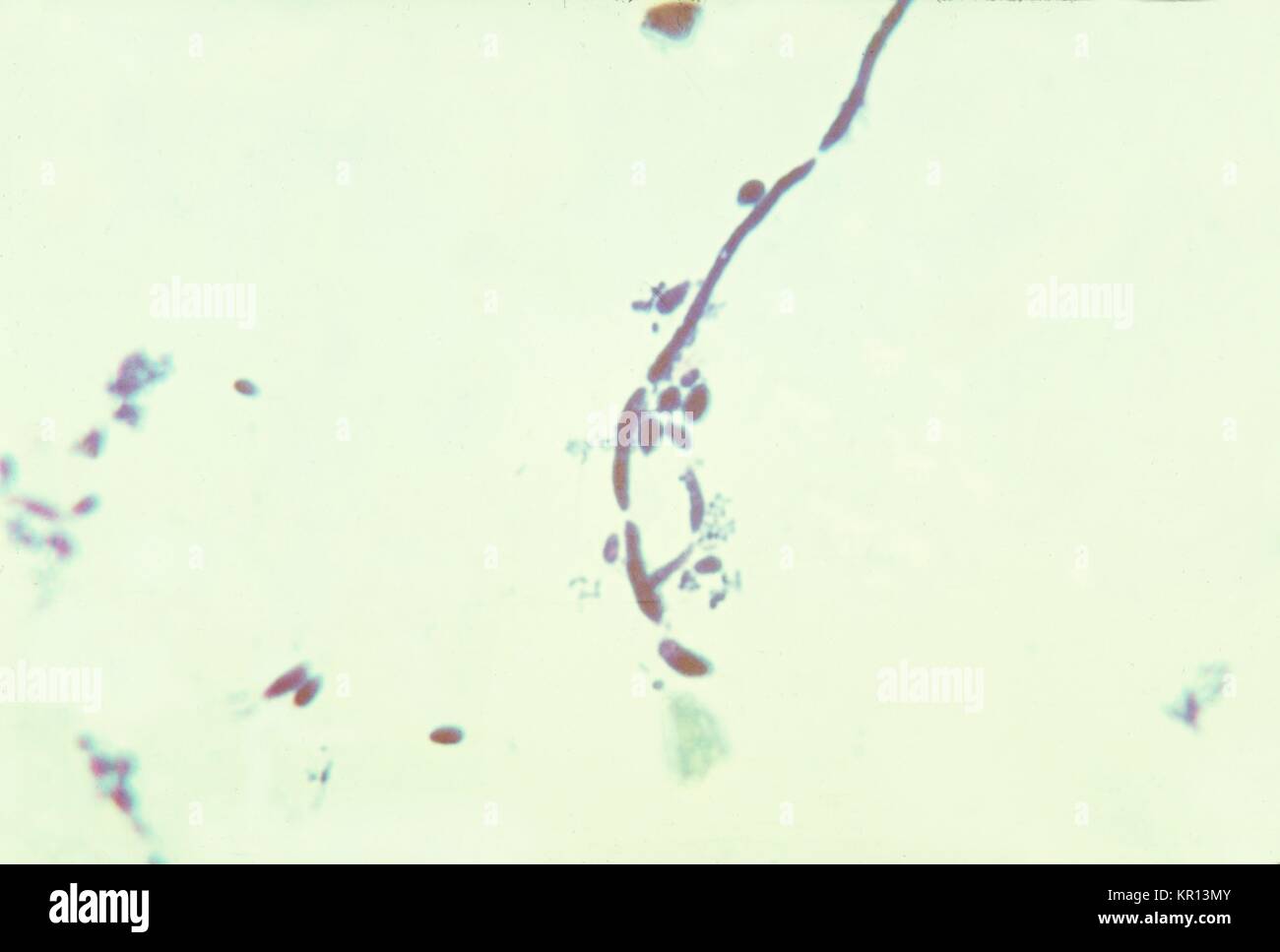 Questa è una microfotografia del fungo Candida albicans in un campione di saliva, 1963. La candida albicans vive in numerose parti del corpo come flora normale. Tuttavia, quando uno squilibrio si verifica, come quando equilibri ormonali cambiare, C. albicans è in grado di moltiplicare, risultante in una mucosa o infezione della pelle chiamato candidosi . Immagine cortesia CDC/Sherry Brinkman. Foto Stock Questa è una microfotografia del fungo Candida albicans in un campione di saliva, 1963. La candida albicans vive in numerose parti del corpo come flora normale. Tuttavia, quando uno squilibrio si verifica, come quando equilibri ormonali cambiare, C. albicans è in grado di moltiplicare, risultante in una mucosa o infezione della pelle chiamato candidosi . Immagine cortesia CDC/Sherry Brinkman. Foto Stock