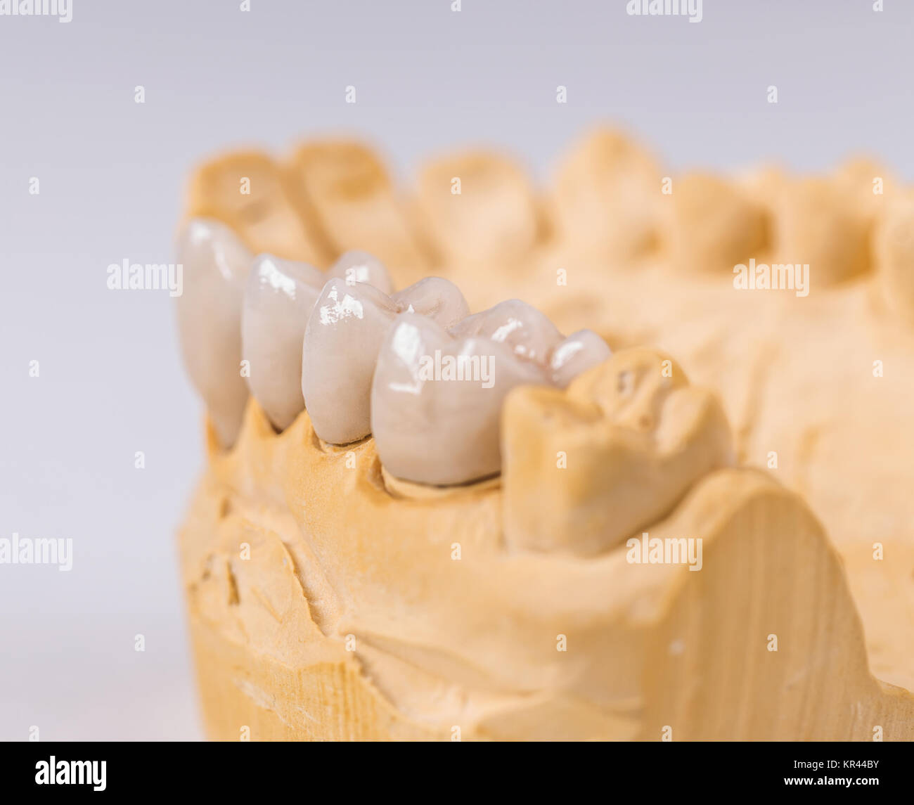 Dentiera realizzata in ceramica Foto Stock