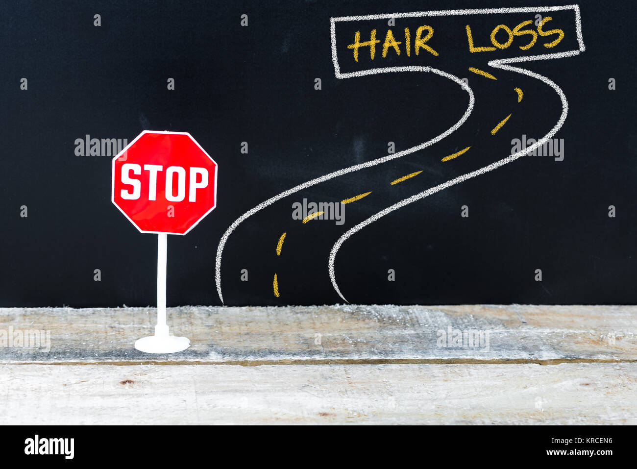 Mini STOP sulla strada per la perdita dei capelli Foto Stock